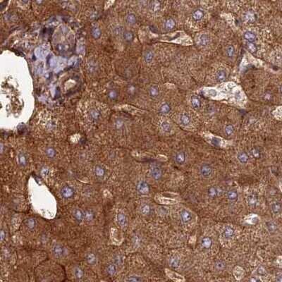 Immunohistochemistry-Paraffin: NULP1 Antibody [NBP1-92210] - Staining of human liver.
