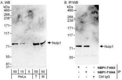 Western Blot: NULP1 Antibody [NBP1-71843] - Whole cell lysate from HeLa (5, 15 and 50 mcg for WB; 1 mg for IP, 20% of IP loaded), 293T (T, 50 mcg) and mouse NIH3T3 (M; 50 mcg) cells.  Affinity purified rabbit anti-Nulp1 antibody  used for WB at 0.04 mcg/ml (A) and 0.4 mcg/ml (B) and used for IP at 6 mcg/mg lysate.  Nulp1 was also immunoprecipitated by rabbit anti-Nulp1 antibody NBP1-71844 which recognizes a downstream epitope.