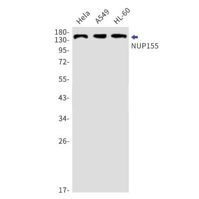 Western Blot: NUP155 Antibody (S03-6F7) [NBP3-19898] - Western blot detection of NUP155 in Hela, A549, HL-60 cell lysates using NBP3-19898 (1:1000 diluted). Predicted band size: 155kDa. Observed band size: 155kDa.