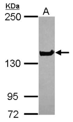 Western Blot: NUP155 Antibody [NBP2-19609] - Sample (30 ug of whole cell lysate) A: NT2D1 5% SDS PAGE gel, diluted at 1:1000.