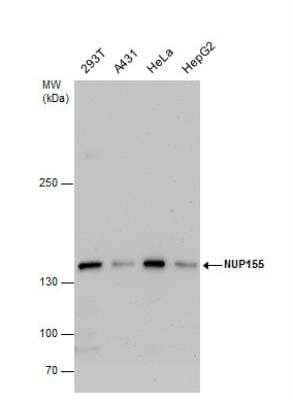 Western Blot: NUP155 Antibody [NBP2-19609] - Various whole cell extracts (30 ug) were separated by 5% SDS-PAGE, and the membrane was blotted with NUP155 antibody diluted by 1:1000