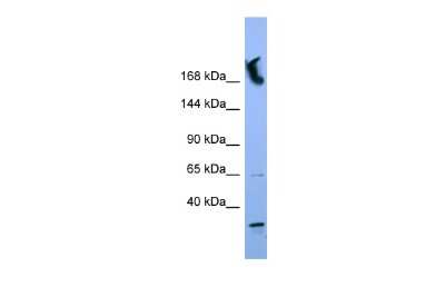 Western Blot: NUP155 Antibody [NBP2-87968] - WB Suggested Anti-NUP155 Antibody Titration: 0.2-1 ug/ml. ELISA Titer: 1:1562500. Positive Control: HT1080 cell lysate