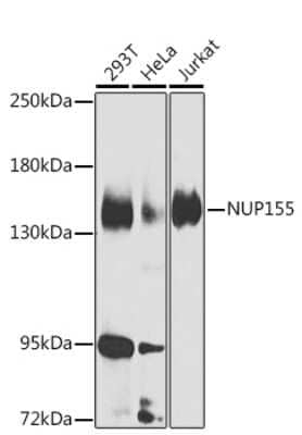 Western Blot: NUP155 Antibody [NBP2-93648] - Analysis of extracts of various cell lines, using NUP155 at 1:1000 dilution.Secondary antibody: HRP Goat Anti-Rabbit IgG (H+L) at 1:10000 dilution.Lysates/proteins: 25ug per lane.Blocking buffer: 3% nonfat dry milk in TBST.Detection: ECL Basic Kit .Exposure time: 45s.