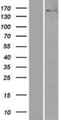 Western Blot: NUP160 Overexpression Lysate (Adult Normal) [NBP2-07199] Left-Empty vector transfected control cell lysate (HEK293 cell lysate); Right -Over-expression Lysate for NUP160.