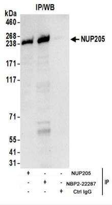 Immunoprecipitation: NUP205 Antibody [NBP2-22287] - Whole cell lysate (1 mg for IP; 20% of IP loaded) from 293T cells.  Antibodies: NBP2-22287 used for IP at 6 ug/mg lysate.  NUP205 was also immunoprecipitated by rabbit anti-NUP205 antibody.  For blotting immunoprecipitated NUP205, NBP2-22287 was used at 1 ug/ml.  Detection: Chemiluminescence with an exposure time of 10 seconds.