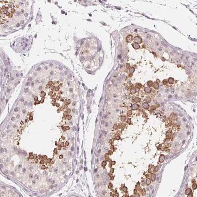 Immunohistochemistry: NUP210L Antibody [NBP2-49414] - Staining of human testis shows strong cytoplasmic positivity in cells in seminiferous ducts.