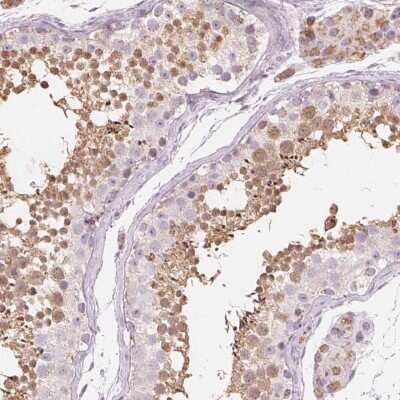Immunohistochemistry: NUP210L Antibody [NBP2-49488] - Staining of human testis shows cytoplasmic positivity in cells in seminiferous ducts.