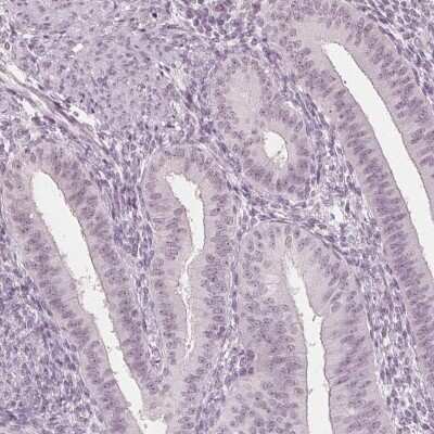 Immunohistochemistry-Paraffin: NUP210L Antibody [NBP2-49414] - Staining of human endometrium shows low expression as expected.
