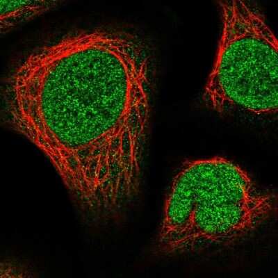 Immunocytochemistry/Immunofluorescence: NUP214 Antibody [NBP2-58412] - Staining of human cell line U-2 OS shows localization to nucleus.