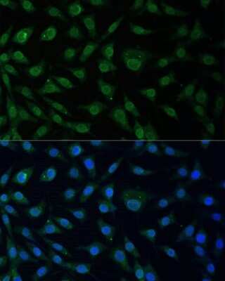 Immunocytochemistry/Immunofluorescence: NUP214 Antibody [NBP2-94556] - Analysis of L929 cells using NUP214 . Blue: DAPI for nuclear staining.