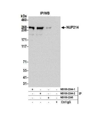 Immunoprecipitation: NUP214 Antibody [NB100-2244] - Detection of human NUP214 by western blot of immunoprecipitates. Samples: Whole cell lysate (0.5 or 1.0 mg per IP reaction; 20% of IP loaded) from HeLa cells prepared using NETN lysis buffer. Antibodies: Affinity purified rabbit anti-NUP214 antibody NB100-2244 (lot 2) used for IP at 6 ug per reaction. NUP214 was also immunoprecipitated by a previous lot of this antibody (lot 1) and rabbit anti-NUP214 antibody NB100-2245. For blotting immunoprecipitated NUP214, NB100-2244 was used at 0.4 ug/ml. Detection: Chemiluminescence with an exposure time of 30 seconds.