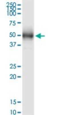 Western Blot: NUP43 Antibody (2G5) [H00348995-M03] - Analysis of NUP43 expression in human colon.