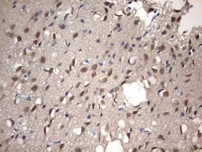 Immunohistochemistry: NUP43 Antibody (6F8) [NBP2-46285] - Analysis of Human adult brain tissue. (Heat-induced epitope retrieval by 1 mM EDTA in 10mM Tris, pH8.5, 120C for 3min)