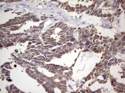 Immunohistochemistry: NUP43 Antibody (6F8) [NBP2-46285] - Analysis of Human testicular cancer tissue. (Heat-induced epitope retrieval by 1 mM EDTA in 10mM Tris, pH8.5, 120C for 3min)