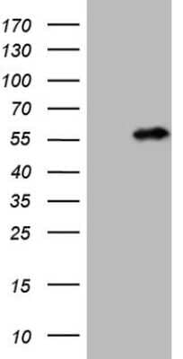 Western Blot: NUP43 Antibody (6F8) [NBP2-46285] - Analysis of HEK293T cells were transfected with the pCMV6-ENTRY control (Left lane) or pCMV6-ENTRY NUP43.