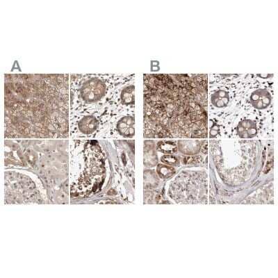 Immunohistochemistry-Paraffin: NUP43 Antibody [NBP1-88791] - Staining of human adrenal gland, colon, kidney and testis using Anti-NUP43 antibody NBP1-88791 (A) shows similar protein distribution across tissues to independent antibody NBP1-88793 (B).