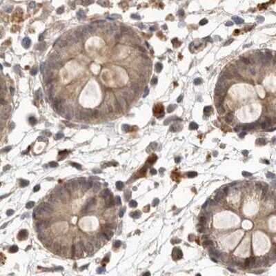 Immunohistochemistry-Paraffin: NUP43 Antibody [NBP1-88791] - Staining of human colon.