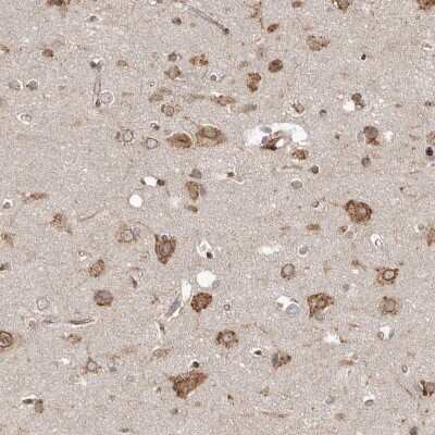 Immunohistochemistry-Paraffin: NUP43 Antibody [NBP1-88792] - Staining of human cerebral cortex shows cytoplasmic and nuclear positivity in neuronal cells and glial cells.