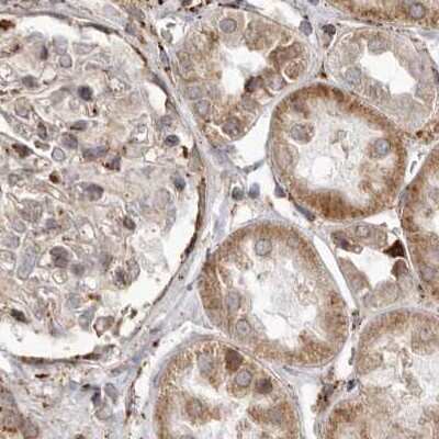 Immunohistochemistry-Paraffin: NUP43 Antibody [NBP1-88792] - Staining of human kidney.