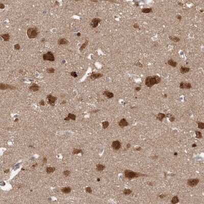 Immunohistochemistry-Paraffin: NUP43 Antibody [NBP1-88793] - Staining of human cerebral cortex shows cytoplasmic and nuclear positivity in neuronal cells and glial cells.