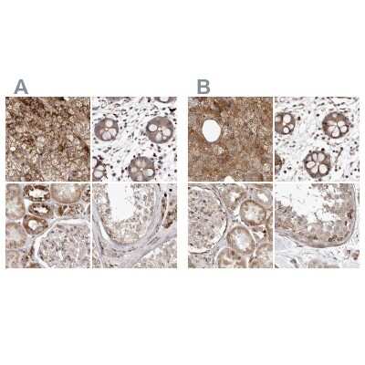 <b>Independent Antibodies Validation. </b>Immunohistochemistry-Paraffin: NUP43 Antibody [NBP1-88793] - Staining of human adrenal gland, colon, kidney and testis using Anti-NUP43 antibody NBP1-88793 (A) shows similar protein distribution across tissues to independent antibody NBP1-88792 (B).