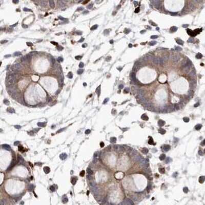 Immunohistochemistry-Paraffin: NUP43 Antibody [NBP1-88793] - Staining of human colon.