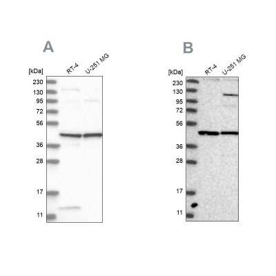 <b>Independent Antibodies Validation. </b>Western Blot: NUP43 Antibody [NBP1-88791] - Analysis using Anti-NUP43 antibody NBP1-88791 (A) shows similar pattern to independent antibody NBP1-88793 (B).