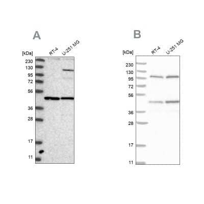 Western Blot: NUP43 Antibody [NBP1-88793] - Analysis using Anti-NUP43 antibody NBP1-88793 (A) shows similar pattern to independent antibody NBP1-88792 (B).