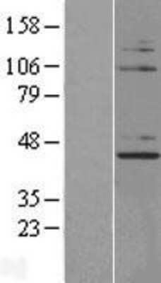 Western Blot: NUP43 Overexpression Lysate (Adult Normal) [NBL1-13876] Left-Empty vector transfected control cell lysate (HEK293 cell lysate); Right -Over-expression Lysate for NUP43.