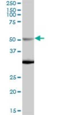 Western Blot: NUP50 Antibody [H00010762-B01P] - Analysis of NUP50 expression in human liver.