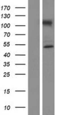 Western Blot: NUP50 Overexpression Lysate (Adult Normal) [NBP2-05241] Left-Empty vector transfected control cell lysate (HEK293 cell lysate); Right -Over-expression Lysate for NUP50.