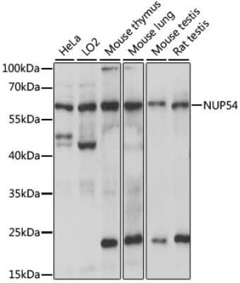 Western Blot: NUP54 Antibody [NBP2-94803] - Analysis of extracts of various cell lines, using NUP54 at 1:1000 dilution.Secondary antibody: HRP Goat Anti-Rabbit IgG (H+L) at 1:10000 dilution.Lysates/proteins: 25ug per lane.Blocking buffer: 3% nonfat dry milk in TBST.Detection: ECL Basic Kit .Exposure time: 10s.