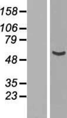 Western Blot: NUP54 Overexpression Lysate (Adult Normal) [NBP2-06983] Left-Empty vector transfected control cell lysate (HEK293 cell lysate); Right -Over-expression Lysate for NUP54.