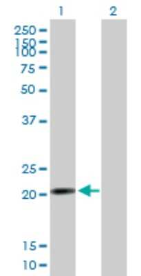 Western Blot: NUP62CL Antibody [H00054830-B01P] - Analysis of RP13-383K5.2 expression in transfected 293T cell line by RP13-383K5.2 polyclonal antibody.  Lane 1: RP13-383K5.2 transfected lysate(20.24 KDa). Lane 2: Non-transfected lysate.