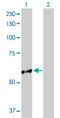 Western Blot: NUP98 Antibody [H00004928-D01P] - Analysis of NUP98 expression in transfected 293T cell line by NUP98 polyclonal antibody.Lane 1: NUP98 transfected lysate(69.80 KDa).Lane 2: Non-transfected lysate.