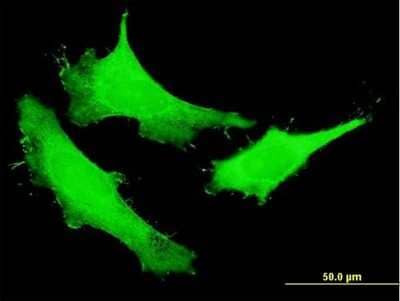 Immunocytochemistry/Immunofluorescence: NUSAP1 Antibody [H00051203-B01P] - Analysis of purified antibody to NUSAP1 on HeLa cell. (antibody concentration 10 ug/ml)