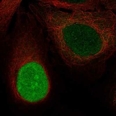 Immunocytochemistry/Immunofluorescence: NUSAP1 Antibody [NBP2-68989] - Staining of human cell line U-2 OS shows localization to nucleus.