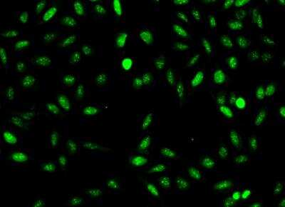 Immunocytochemistry/Immunofluorescence: NUSAP1 Antibody [NBP3-06564] - Staining of NUSAP1 in U2OS cells. Cells were fixed with 4% PFA, permeabilzed with 0.1% Triton X-100 in PBS,blocked with 10% serum, and incubated with rabbit anti-Human NUSAP1 polyclonal antibody (dilution ratio 1:200) at 4? overnight. Then cells were stained with the Alexa Fluor®488-conjugated Goat Anti-rabbit IgG secondary antibody (green). Positive staining was localized to Nucleus.