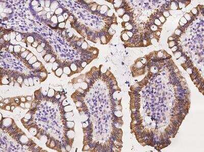 Immunohistochemistry-Paraffin: NUSAP1 Antibody [NBP3-06564] - Staining of human NUSAP1 in human small intestine with rabbit polyclonal antibody at 1:1000 dilution.