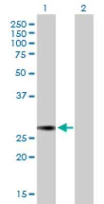 Western Blot: NUSAP1 Antibody [H00051203-B01P] - Analysis of NUSAP1 expression in transfected 293T cell line by NUSAP1 polyclonal antibody.  Lane 1: NUSAP1 transfected lysate(24.86 KDa). Lane 2: Non-transfected lysate.