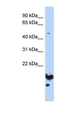 Western Blot: NUSAP1 Antibody [NBP1-53047] - HepG2 cell lysate, concentration 0.2-1 ug/ml.