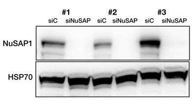 Western Blot: NUSAP1 Antibody [NBP2-13685] - Human cancer cell lines. NuSAP1 protein expression 72 hours after siRNA transfection. WB image submitted by a verified customer review.