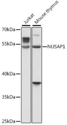 Western Blot: NUSAP1 Antibody [NBP3-04757] - Analysis of extracts of various cell lines, using NUSAP1 antibody at 1:1000 dilution. Secondary antibody: HRP Goat Anti-Rabbit IgG (H+L) at 1:10000 dilution. Lysates/proteins: 25ug per lane. Blocking buffer: 3% nonfat dry milk in TBST. Detection: ECL Basic Kit