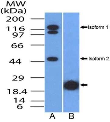 Western Blot: NUT Antibody (1G6) - Azide and BSA Free [NBP2-80886] - WB analysis of NUT/ NUTM1 protein in (A) human testis lysate and on (B) partial recombinant NUT protein (expected molecular weight ~17kda) with NUT antibody (clone 46B3D2.1G6) at a concentration of 2 ug/ml. In human testis, this antibody detected Isoform 1 and Isoform 2 at ~120 kDa and ~46kDa respectively. Image from the standard format of this antibody.