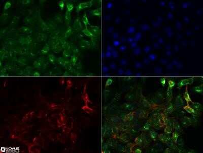 Immunocytochemistry/Immunofluorescence: NUT Antibody (2B6) - Azide and BSA Free [NBP2-80887] - NUT antibody was tested in A431 cells with Dylight 488 (green). Nuclei and alpha-tubulin were counterstained with DAPI (blue) and Dylight 550 (red). An antibody concentration of 0.01 ug/ml was used. Image objective 40x. Image from the standard format of this antibody.