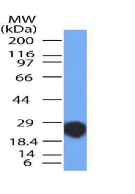 Western Blot: NUT Antibody (2B6) - Azide and BSA Free [NBP2-80887] - WB analysis of partial recombinant NUT protein (expected molecular weight ~17 kDa) with NUT antibody (clone 46B4G9.2B6) at a concentration of 2 ug/ml. Image from the standard format of this antibody.