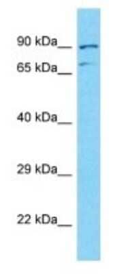 Western Blot: NUTM2A Antibody [NBP3-09707] - Western blot analysis of NUTM2A in Human HT1080 Whole Cell . Antibody dilution at 1ug/ml
