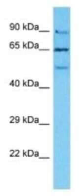 Western Blot: NUTM2B Antibody [NBP3-09918] - Western blot analysis of NUTM2B in Human PANC1 Whole Cell . Antibody dilution at 1ug/ml
