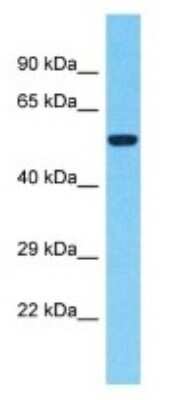 Western Blot: NUTM2F Antibody [NBP3-09708] - Western blot analysis of NUTM2F in U937 Whole cell lysates. Antibody dilution at 1.0ug/ml