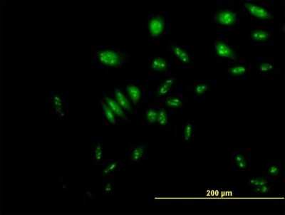Immunocytochemistry/Immunofluorescence: NVL Antibody [H00004931-B01P] - Analysis of purified antibody to NVL on HeLa cell. (antibody concentration 10 ug/ml)
